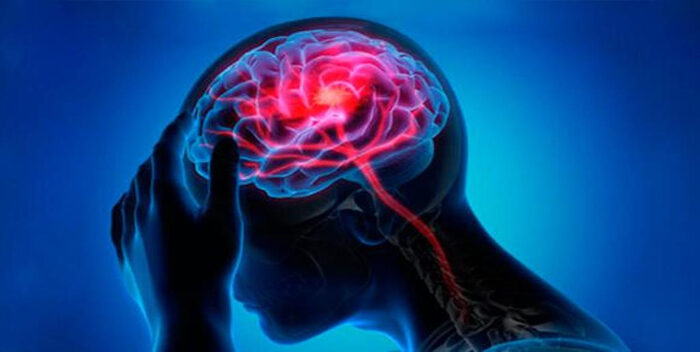 ¿Qué condiciona una buena salud cerebral?